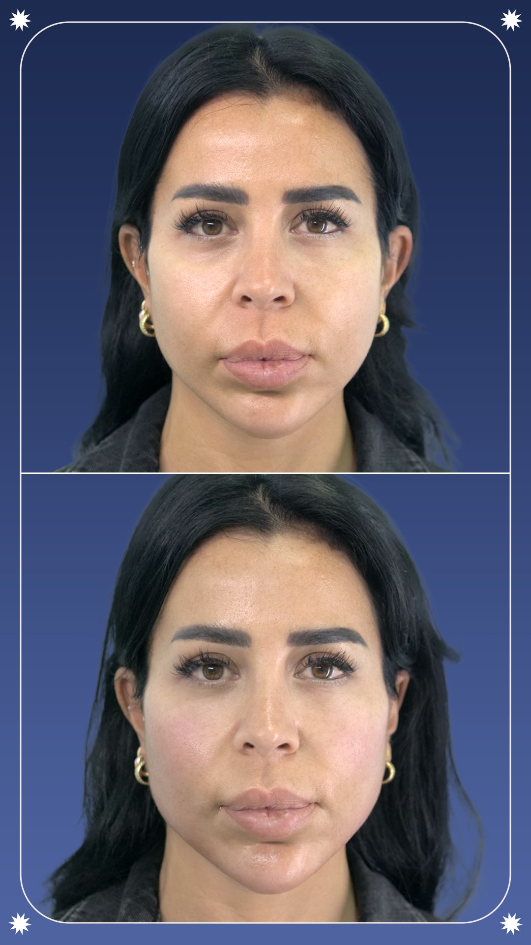 MD - 7D Case 01-1 - Story