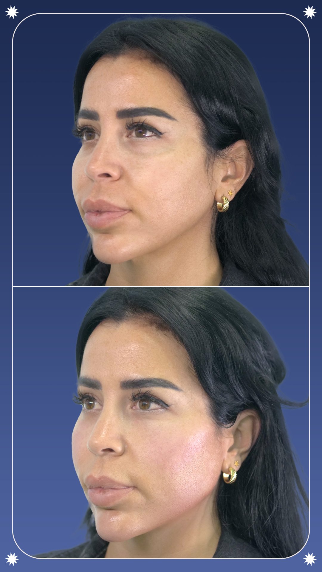 MD - 7D Case 01-2 - Story