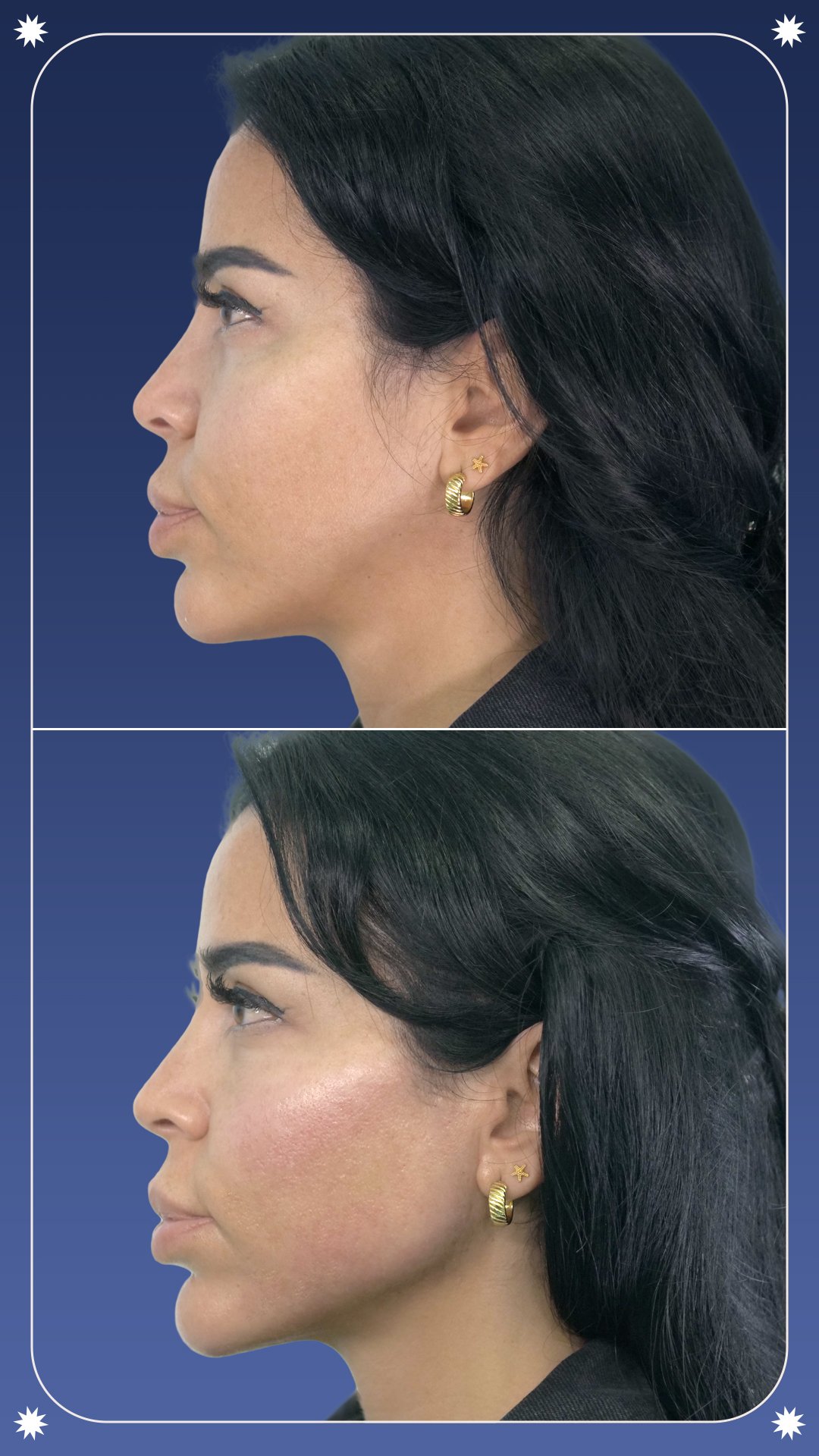 MD - 7D Case 01-3 - Story